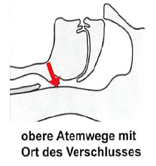 Praxis Pujol: Schlafdiagnostik